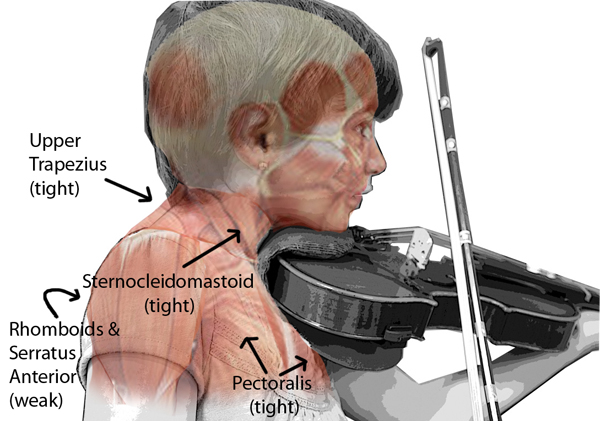 Image result for musician bad posture
